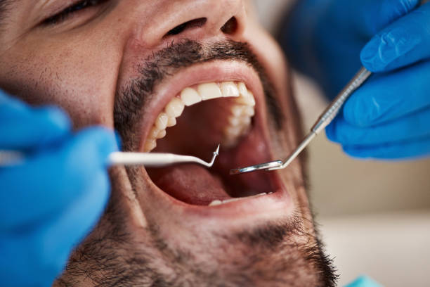 Best Emergency Treatment for Dental Infections or Abscesses in Varnville, SC